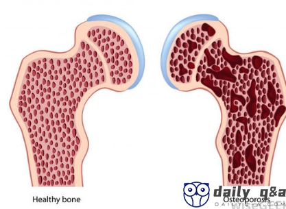 What effect does calcium have to human body