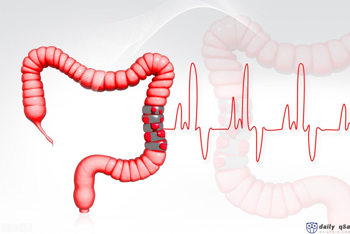 When colorectal cancer comes home, the body may issue 5 warnings!  These 7 types of high-risk groups should pay attention in advance