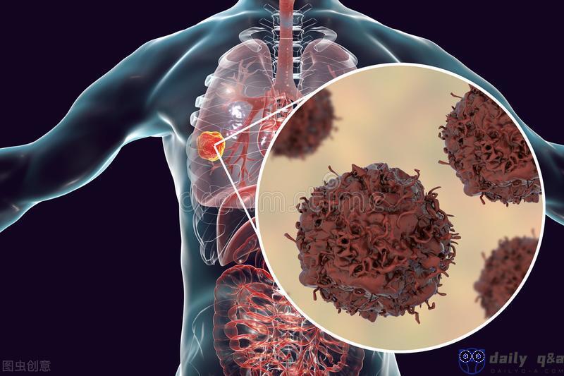 As a country with a large population, the number of new cancers in China is three times that of India!  5 differences are the key